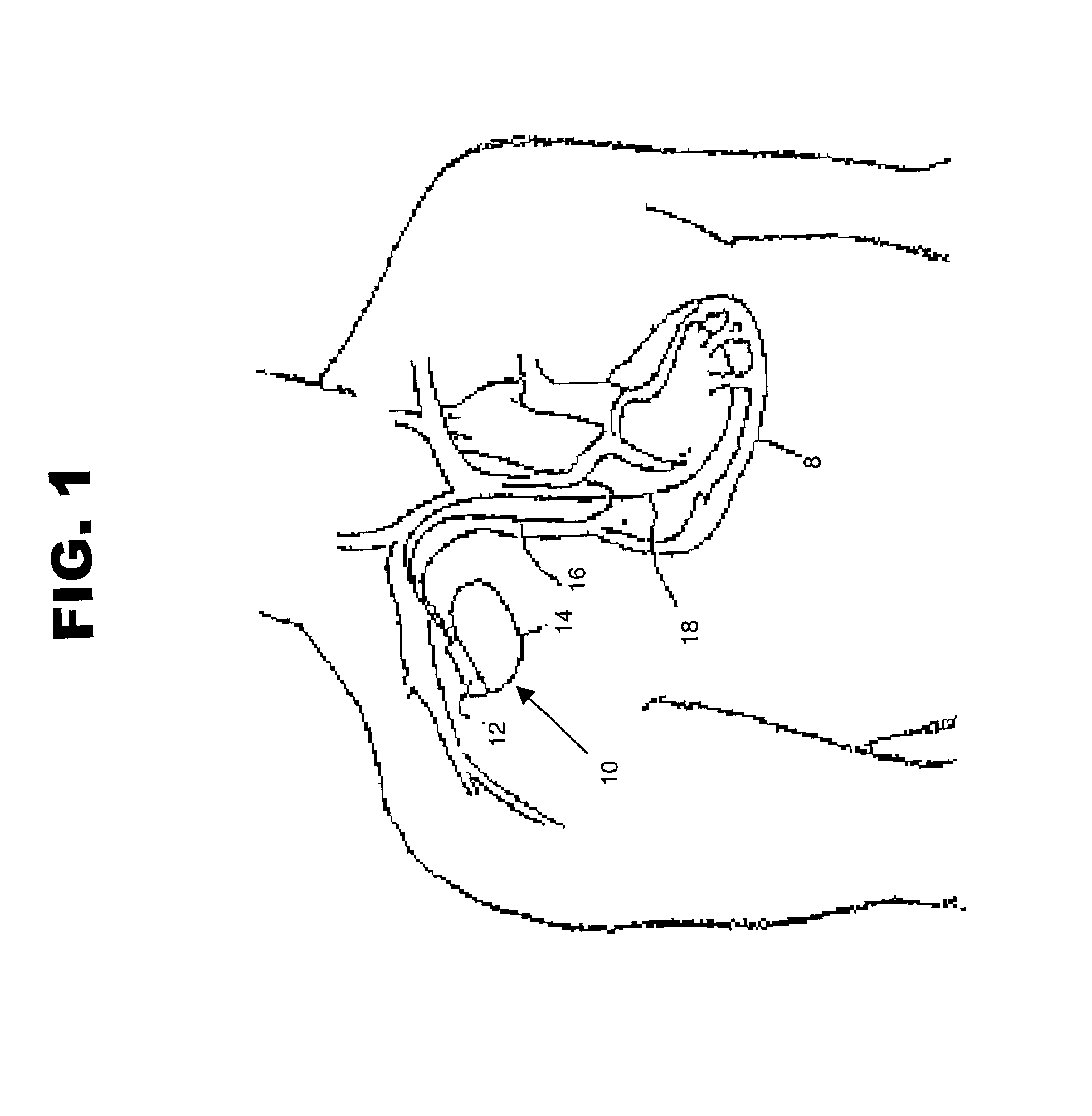 Method and system for discriminating captured beats from non-captured beats in a cardiac pacing system