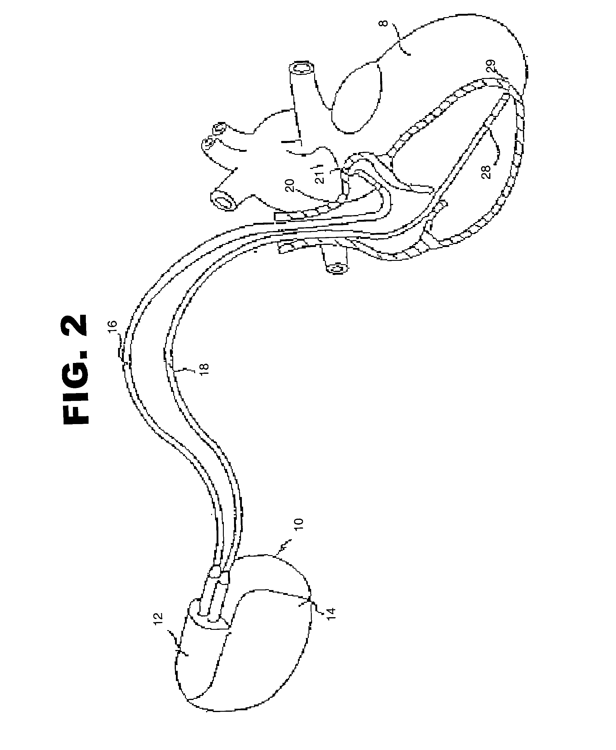 Method and system for discriminating captured beats from non-captured beats in a cardiac pacing system