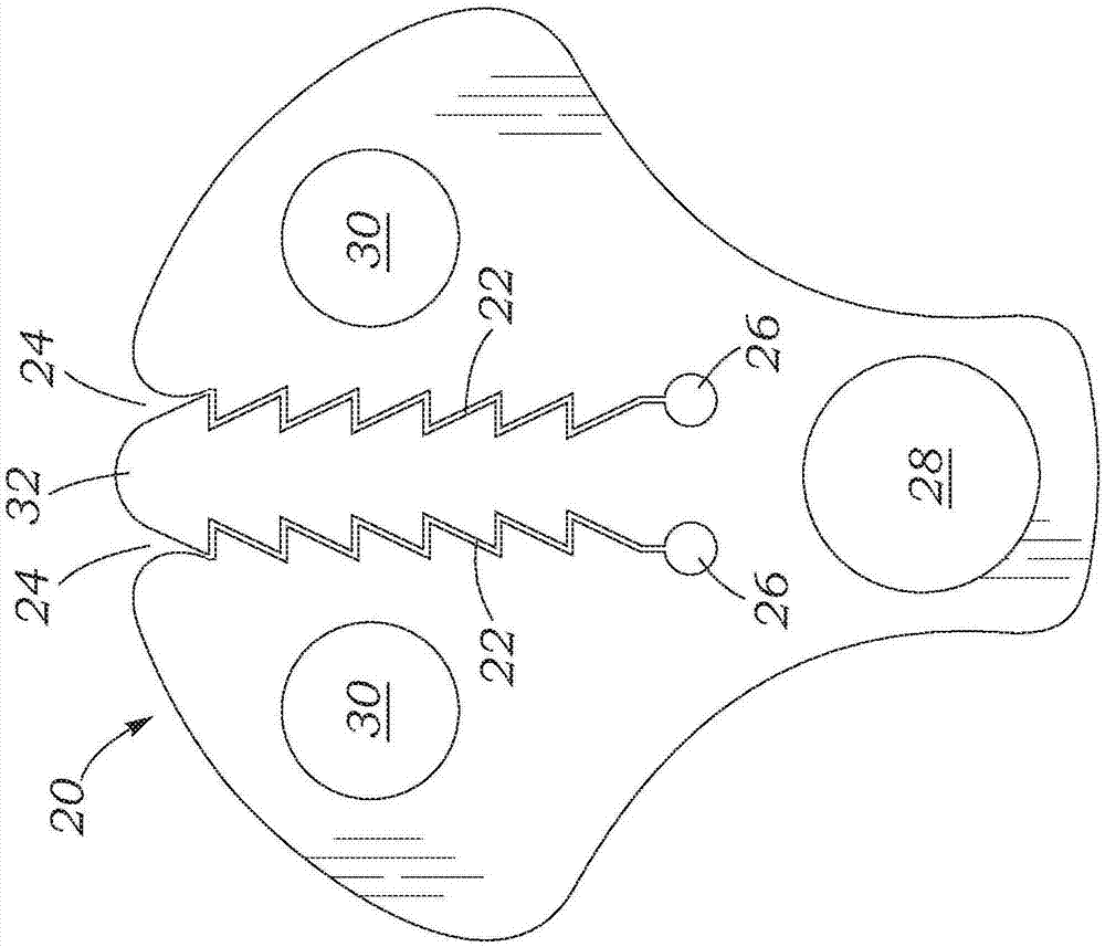 Suture securement devices