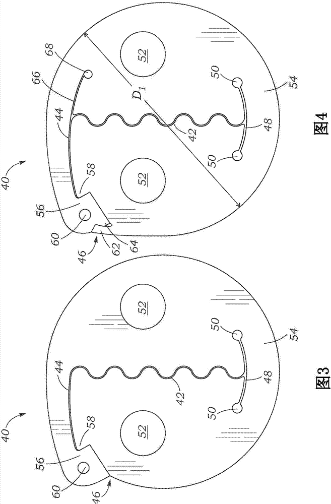 Suture securement devices