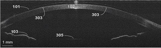 OCT (Optical Coherence Tomography) imaging system and method for monitoring shaping effect of orthokeratology lens by using living body
