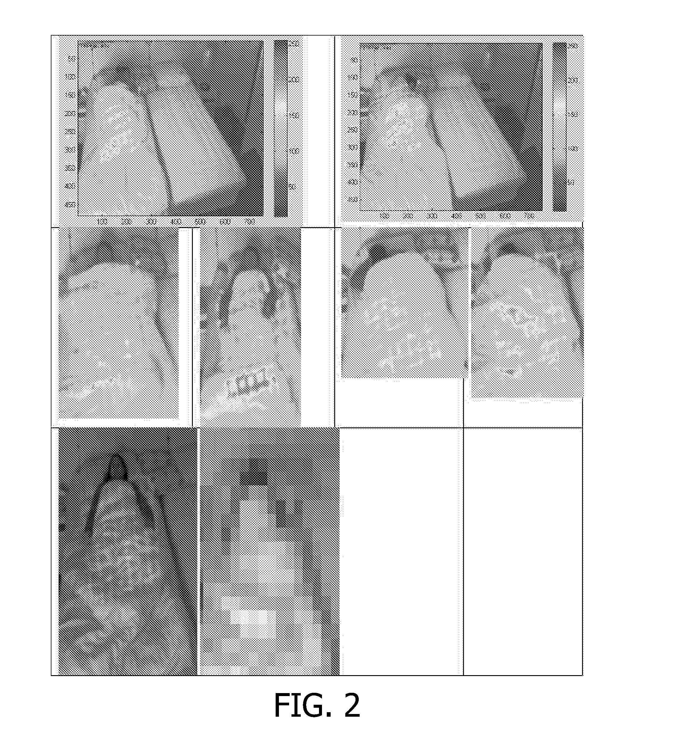 Apparatus and method for the detection of the body position while sleeping