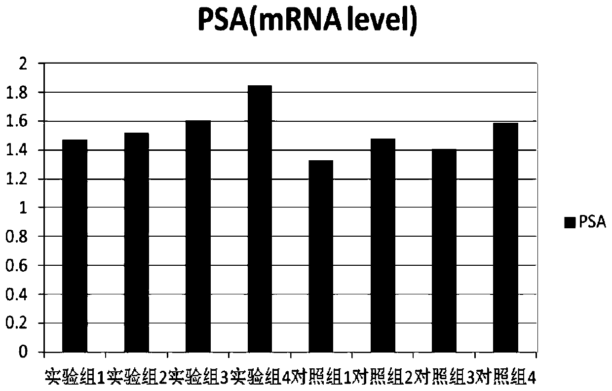 Human prostate epithelial cell separating and culturing method