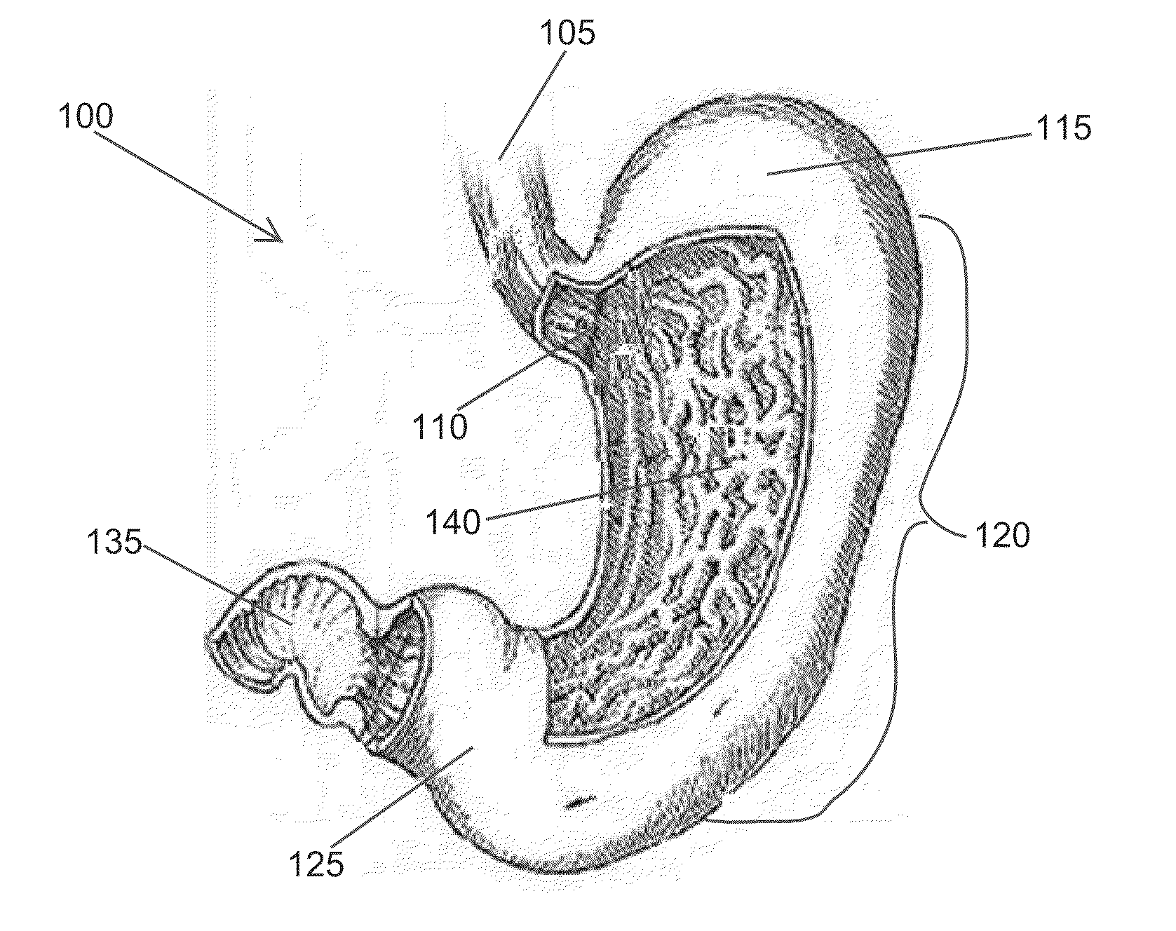 High specific gravity intragastric device