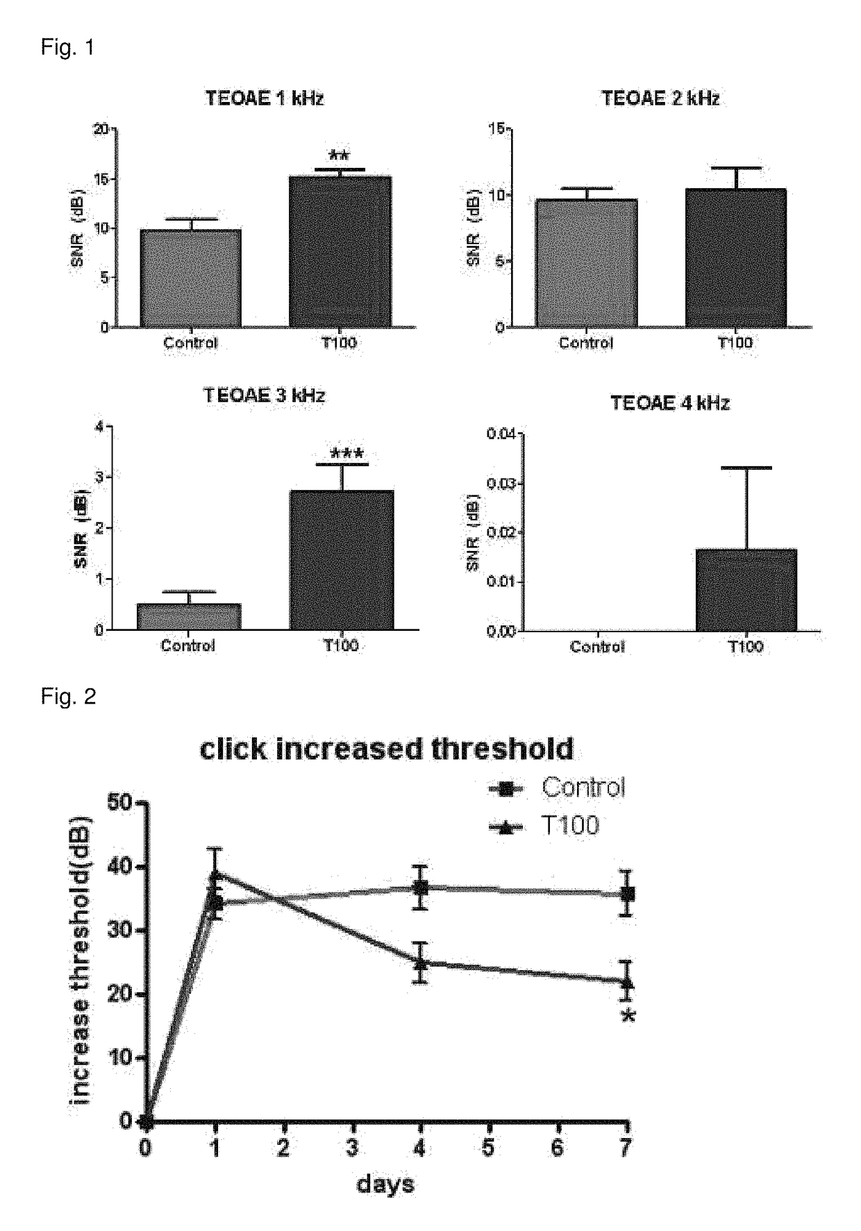 Composition for preventing or treating hearing loss