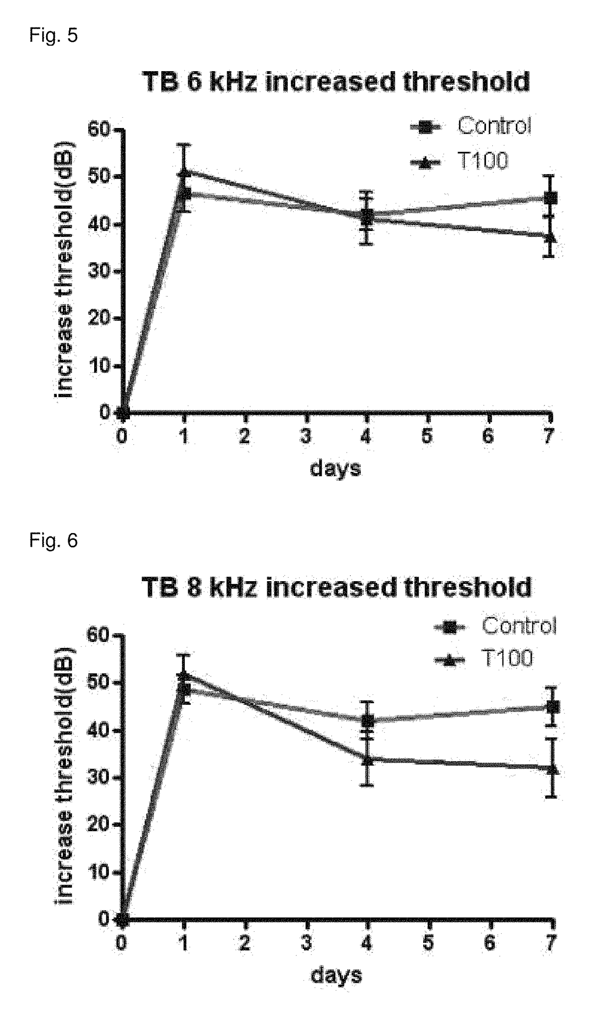 Composition for preventing or treating hearing loss