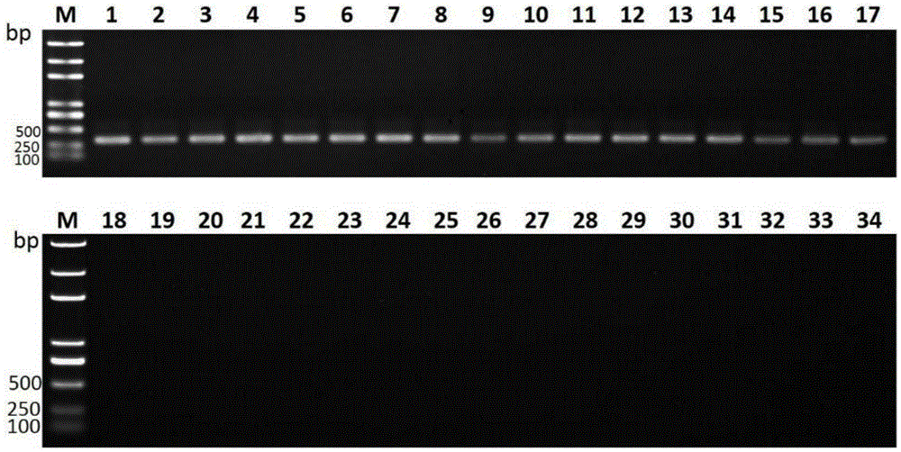 Liver abscess inducing Klebsiella pneumonia specific gene sequence lak and application thereof