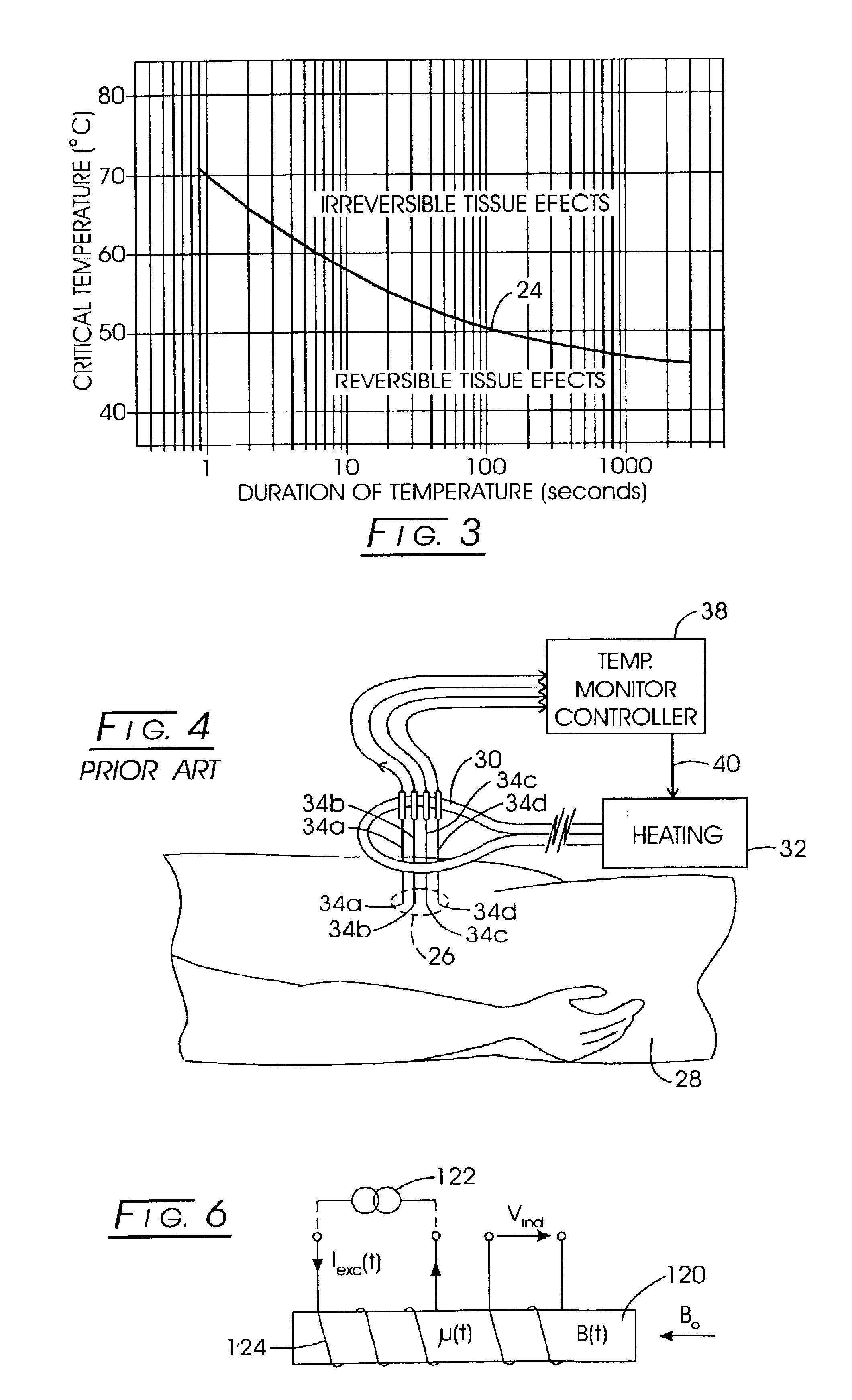 System method and apparatus for localized heating of tissue