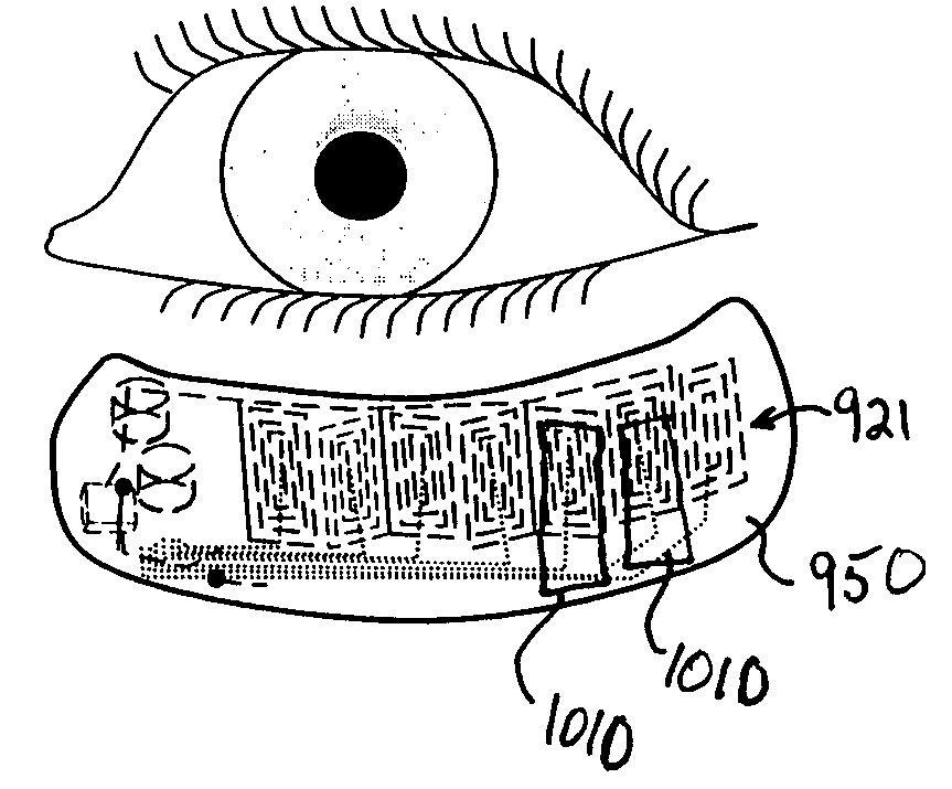 Apparatus and method for reducing vision problems as a result of floaters