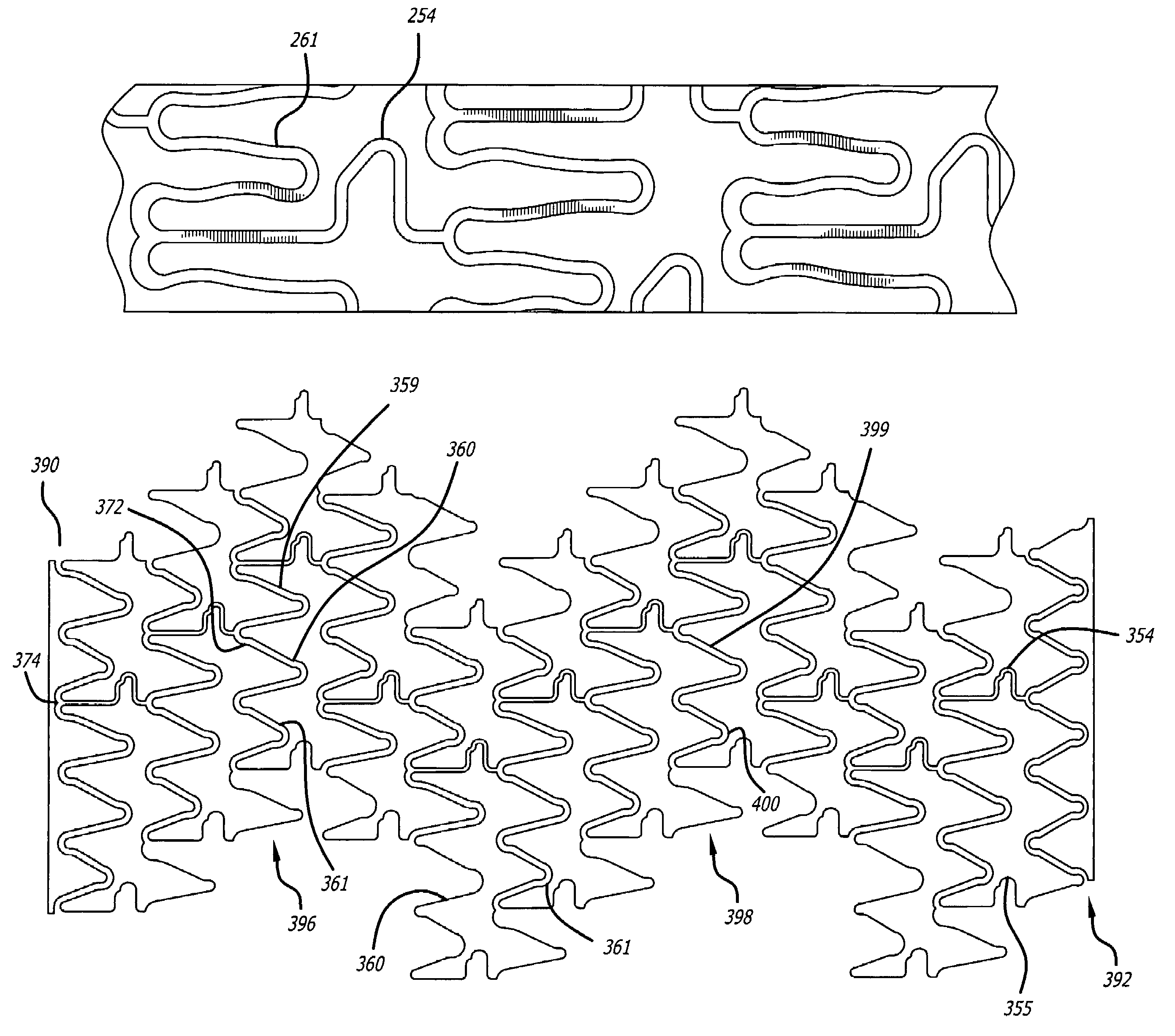 Intravascular stent