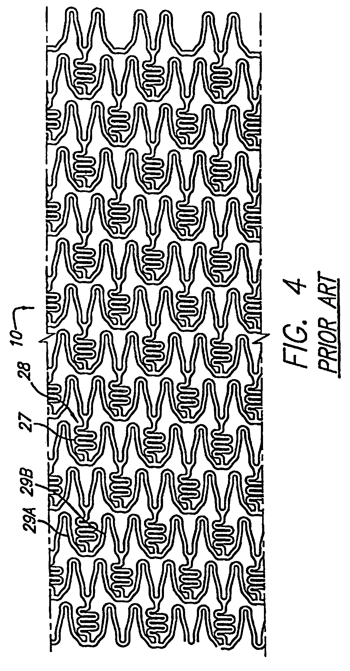 Intravascular stent