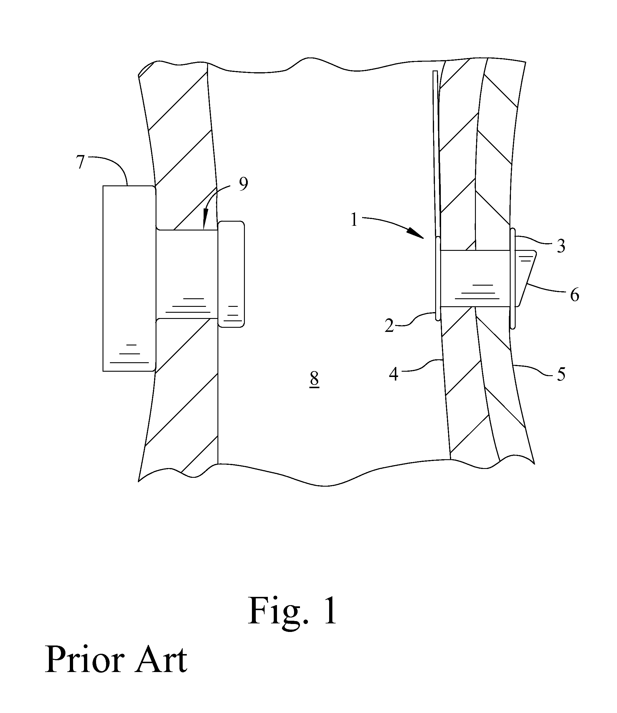 Voice Prosthesis