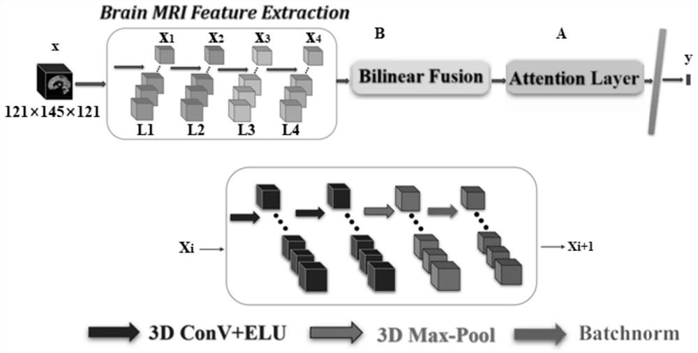 Brain age prediction model and method based on attention mechanism and bilinear fusion