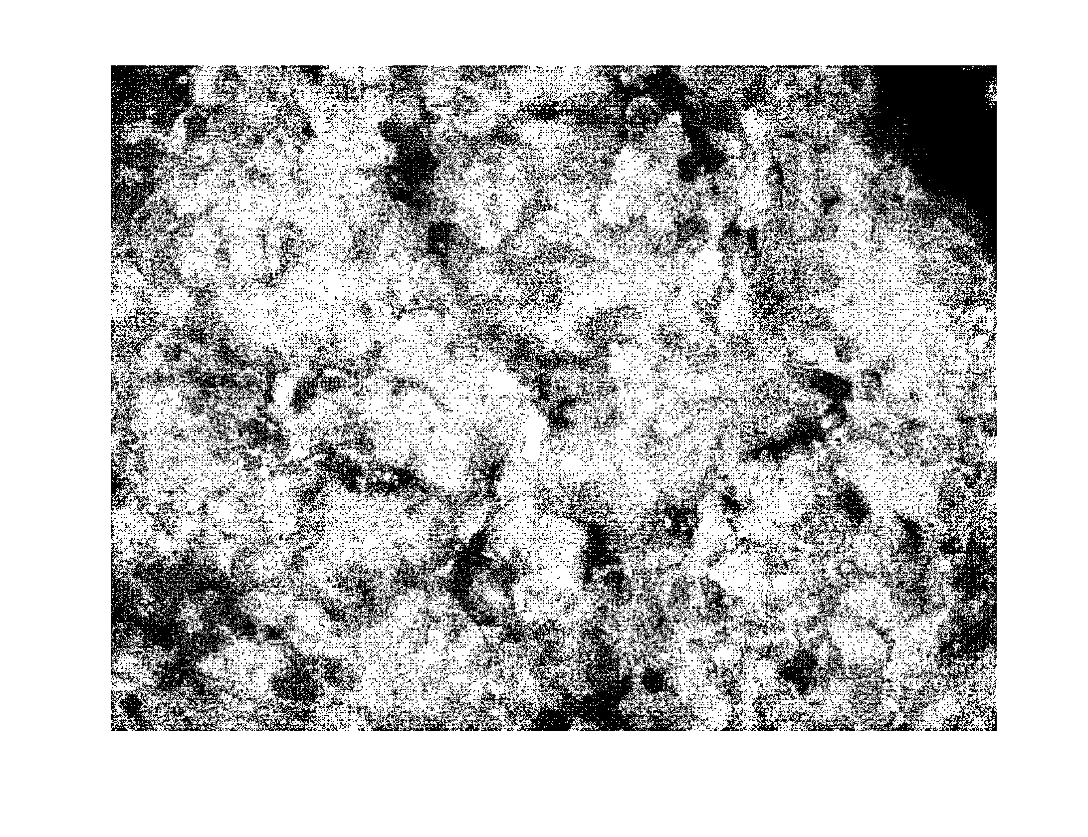 Method for detection of urothelial cancer