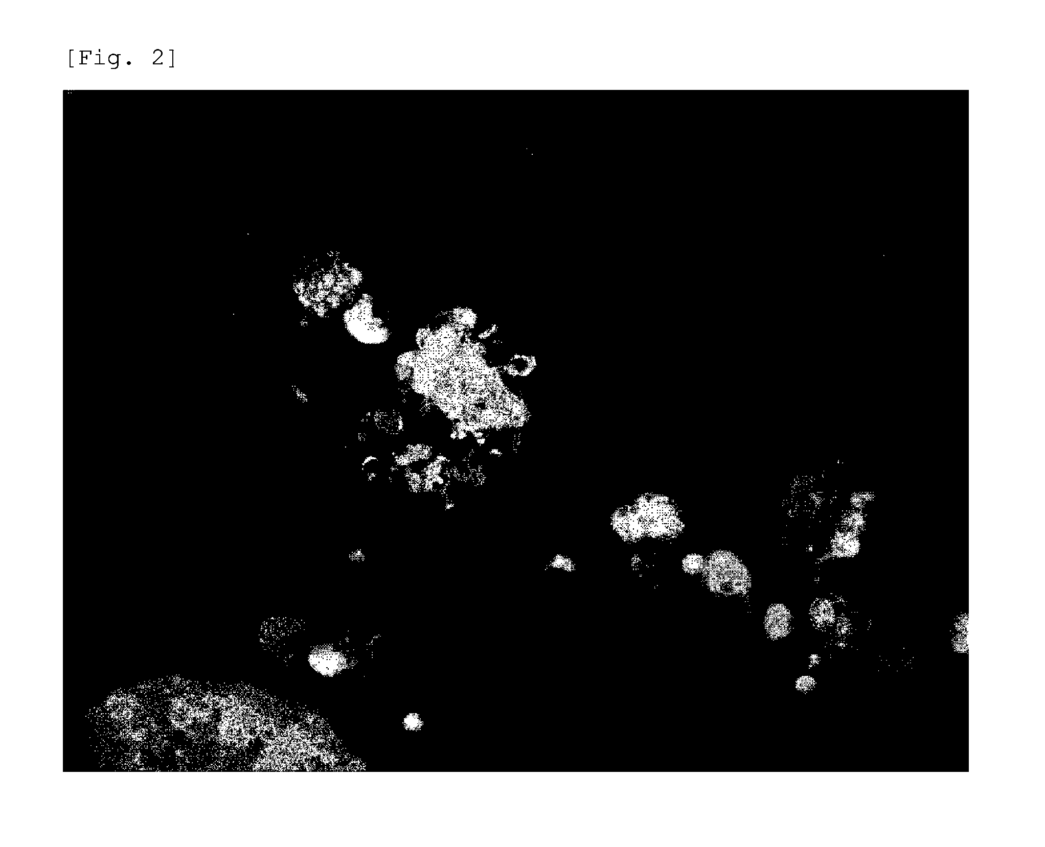 Method for detection of urothelial cancer