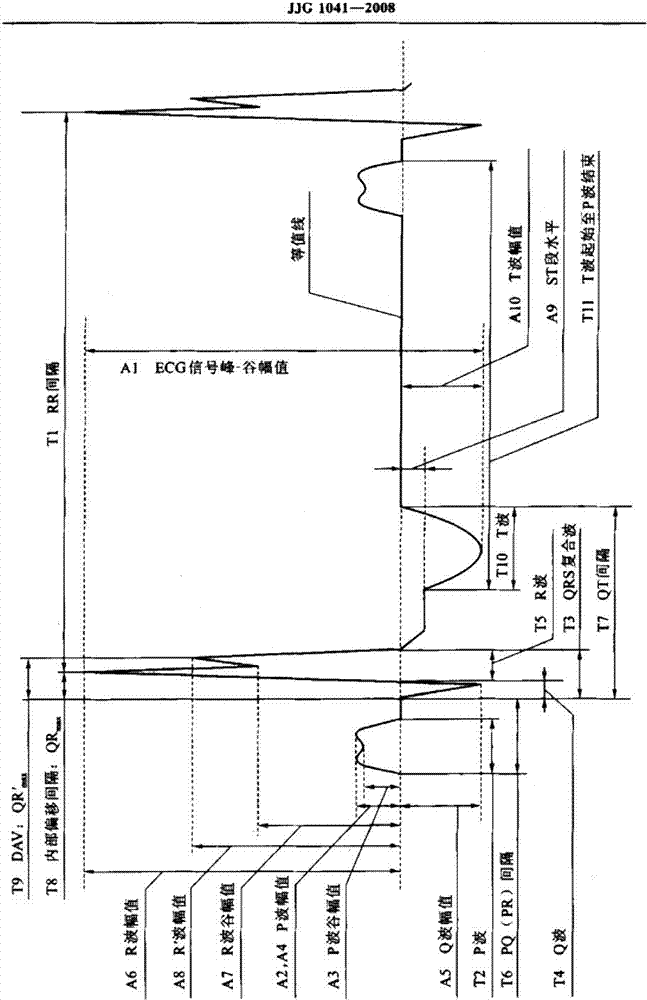 Digital electrocardiograph calibration method and system