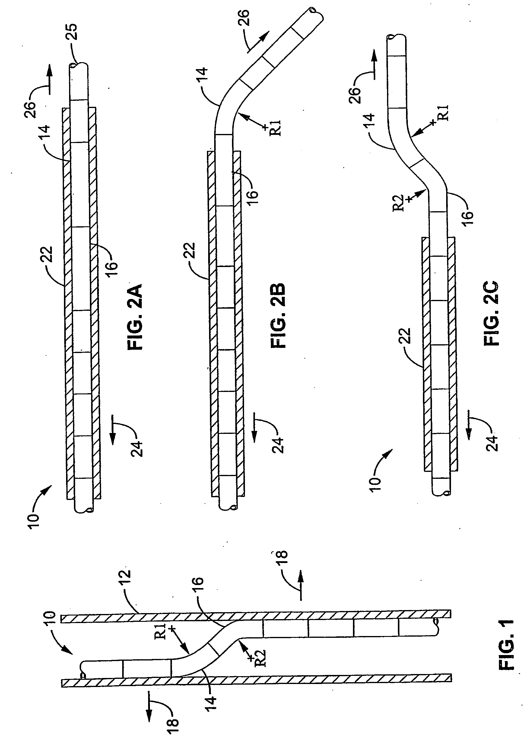 Systems and methods for performing bi-lateral interventions or diagnosis in branched body lumens