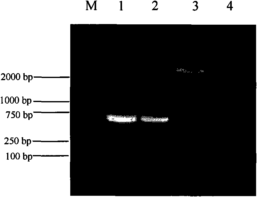 Membrane protein gene of chicken infective bronchitis virus and clone method thereof