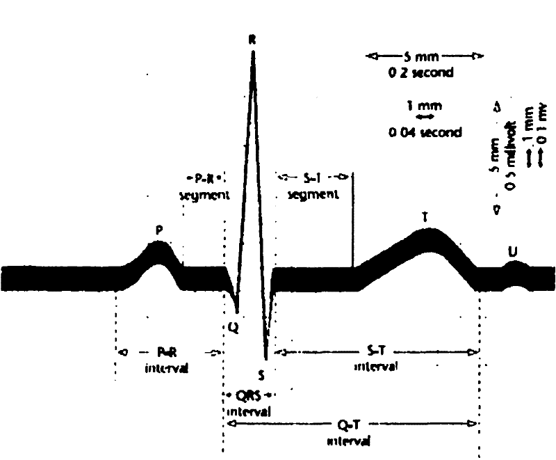 Electrocardiographic data sampling method and device