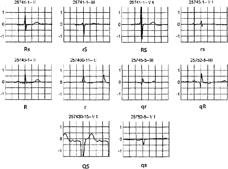 Electrocardiographic data sampling method and device