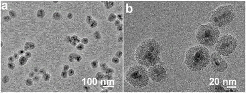 Folic acid coupled targeted ferriferrous oxide/mesoporous silica/copper sulfide nano-composite particle as well as preparation method and application thereof