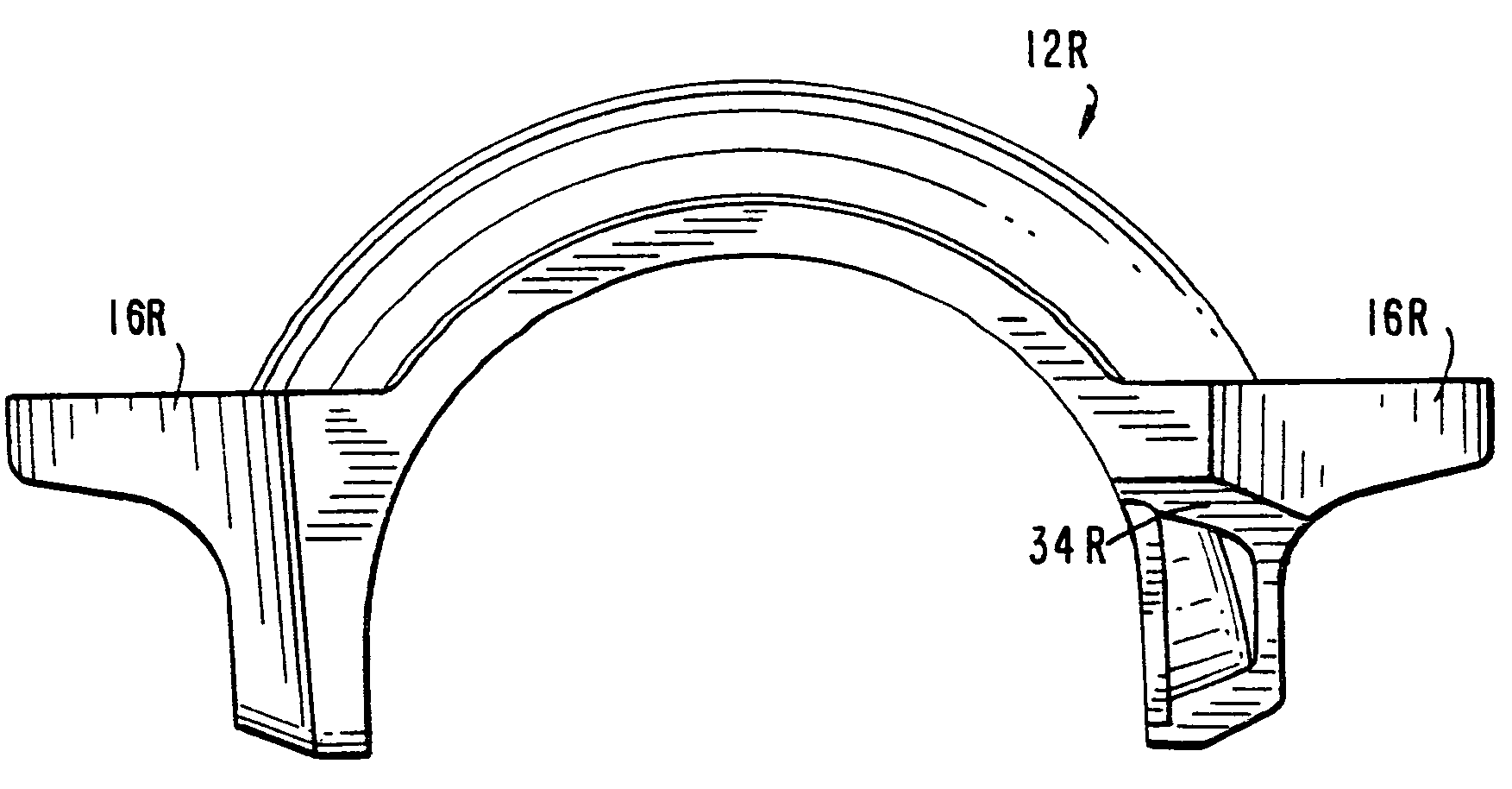 Anti-mismatch of near-sized coupling segments