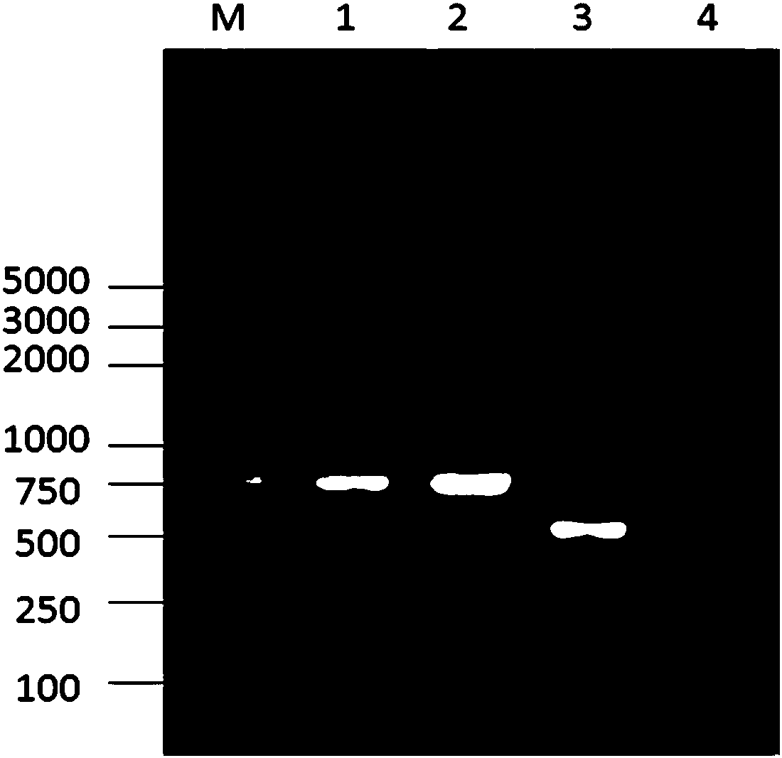 Rapid detection for duplex PCR primer pair of bacillus erysipelatos-suis and streptococcus suis, and kit, and method