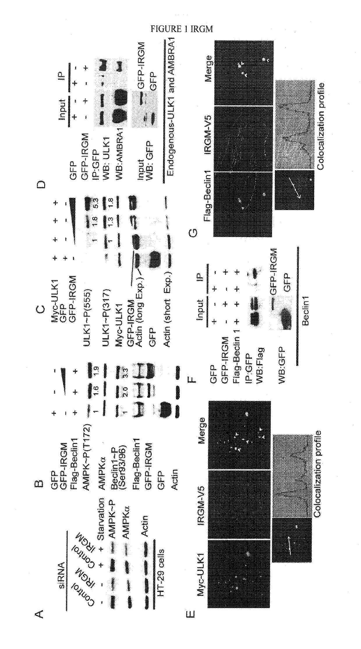 Irgm and precision autophagy controls for antimicrobial and inflammatory disease states and methods of detection of autophagy
