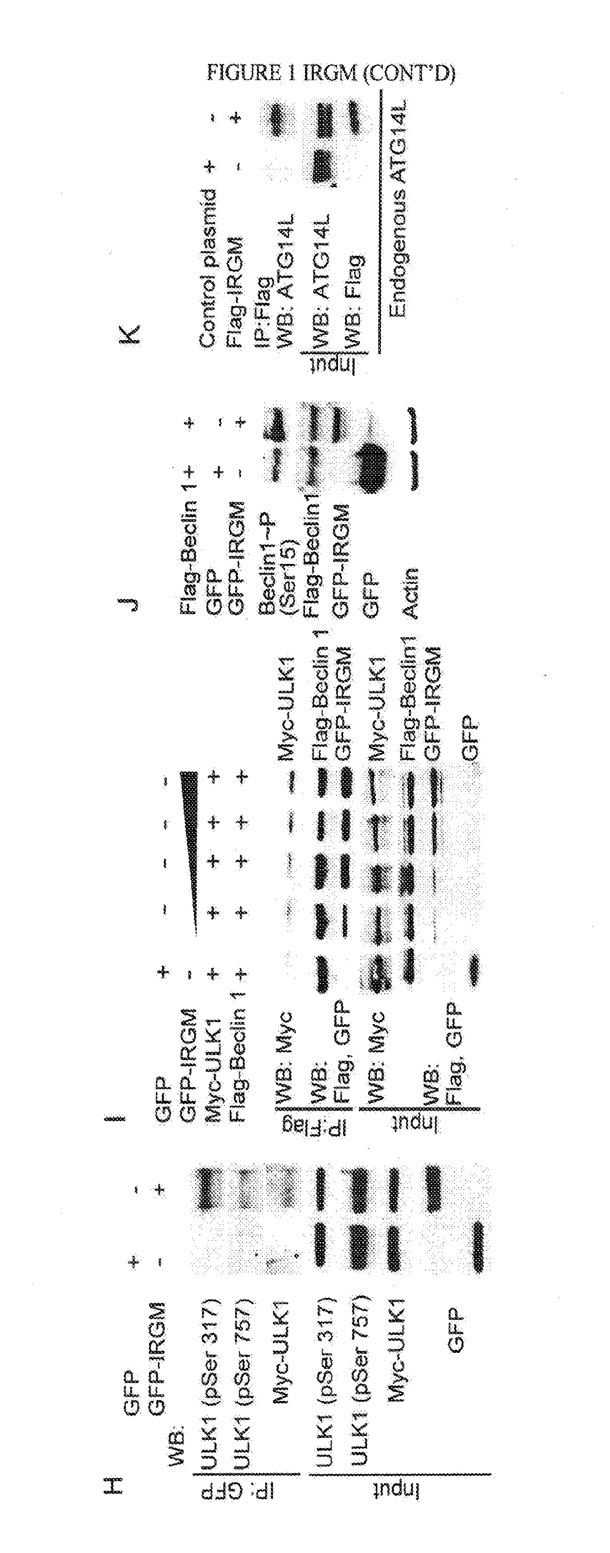Irgm and precision autophagy controls for antimicrobial and inflammatory disease states and methods of detection of autophagy