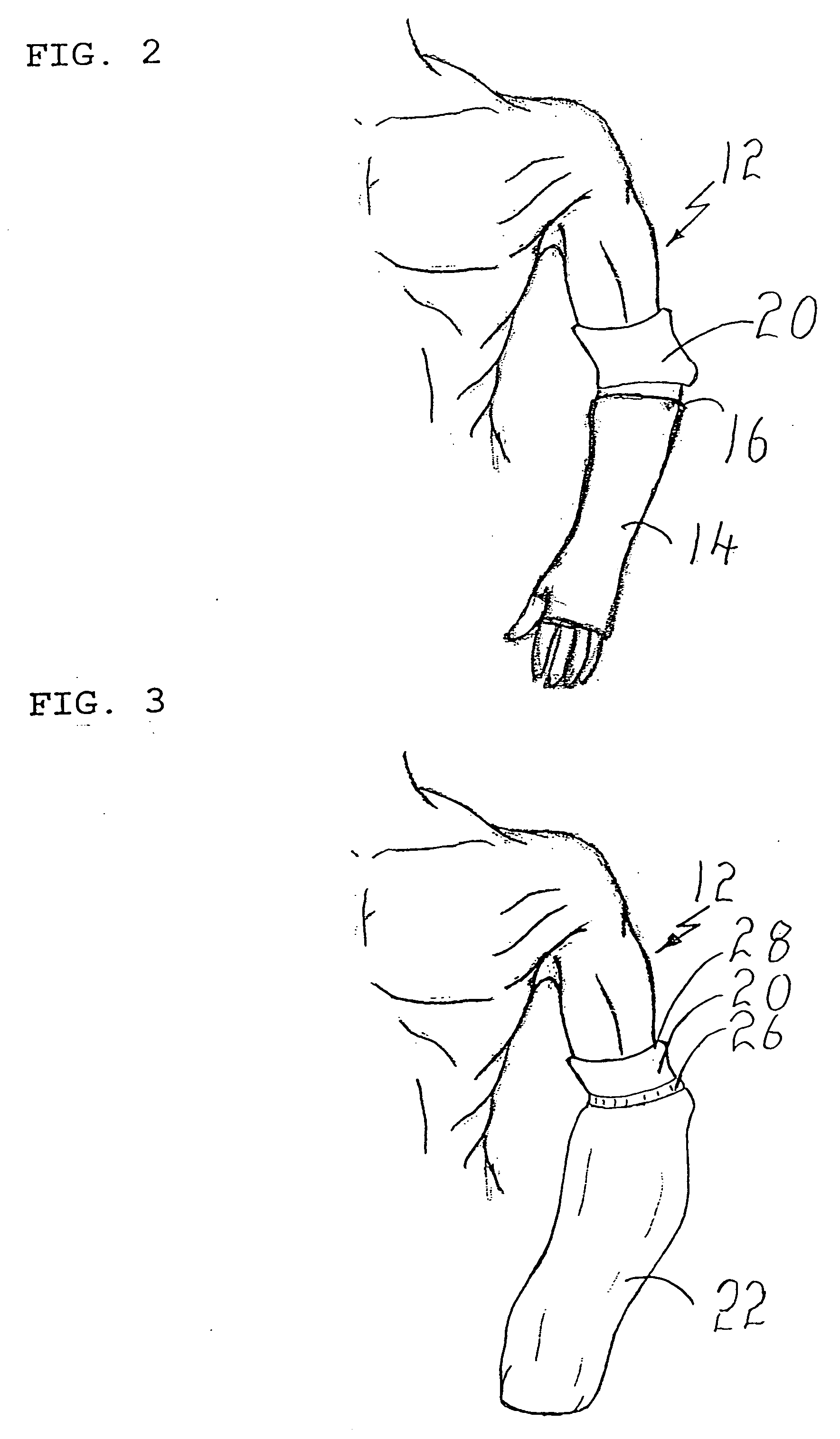 Method of sealing an opening on a waterproof covering for a limb