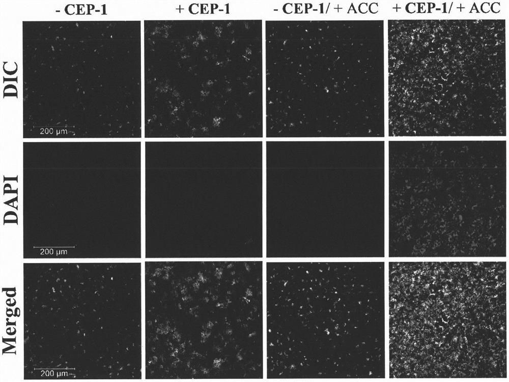 A kind of fluorescent probe for detecting ethylene and its preparation method and application