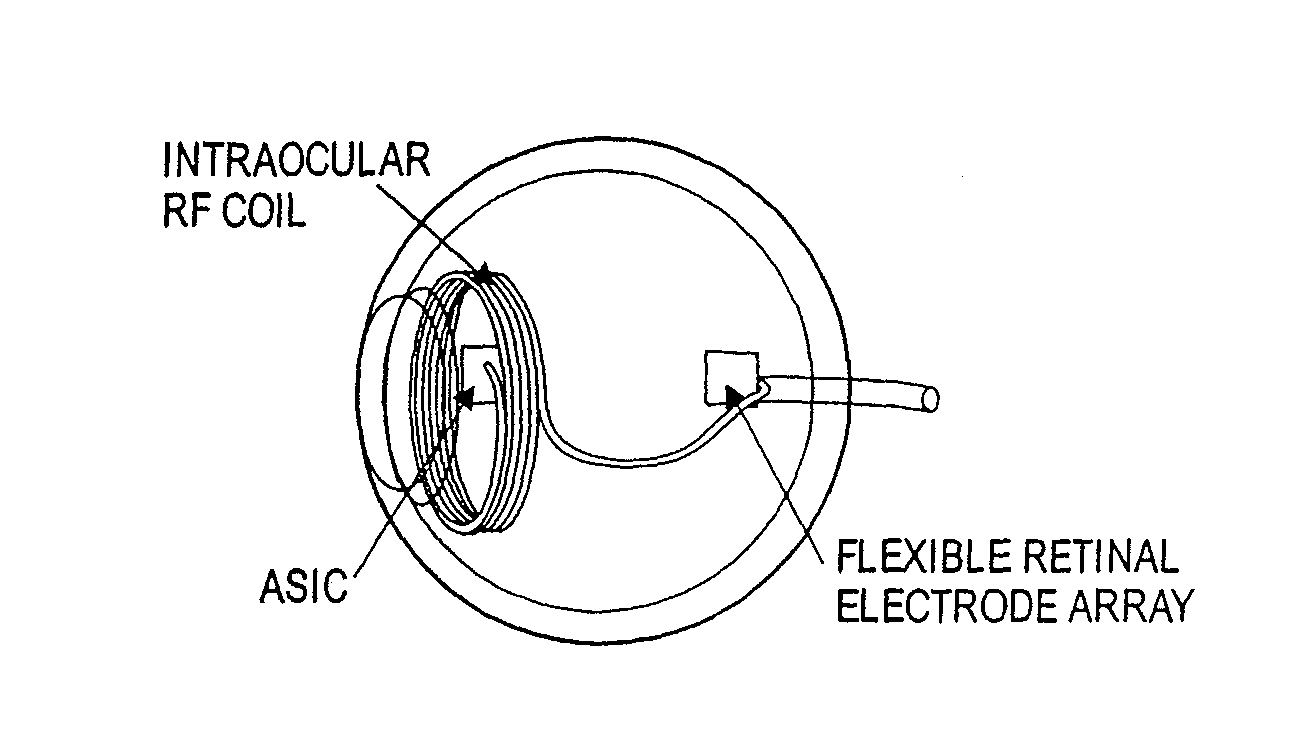Method of fabricating an integrated intraocular retinal prosthesis device