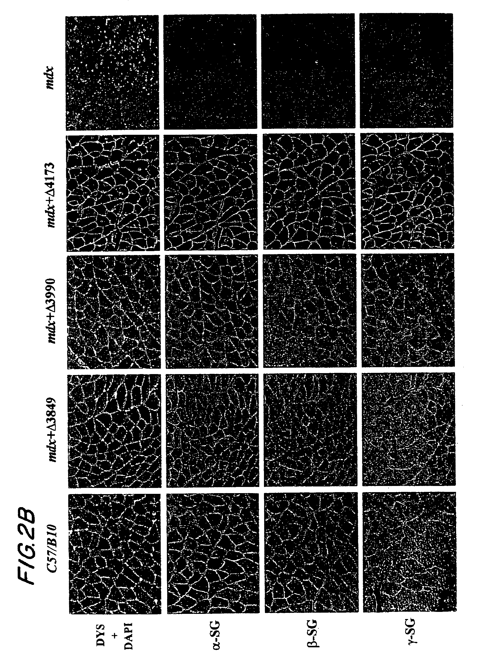 DNA sequences comprising dystrophin minigenes and methods of use thereof