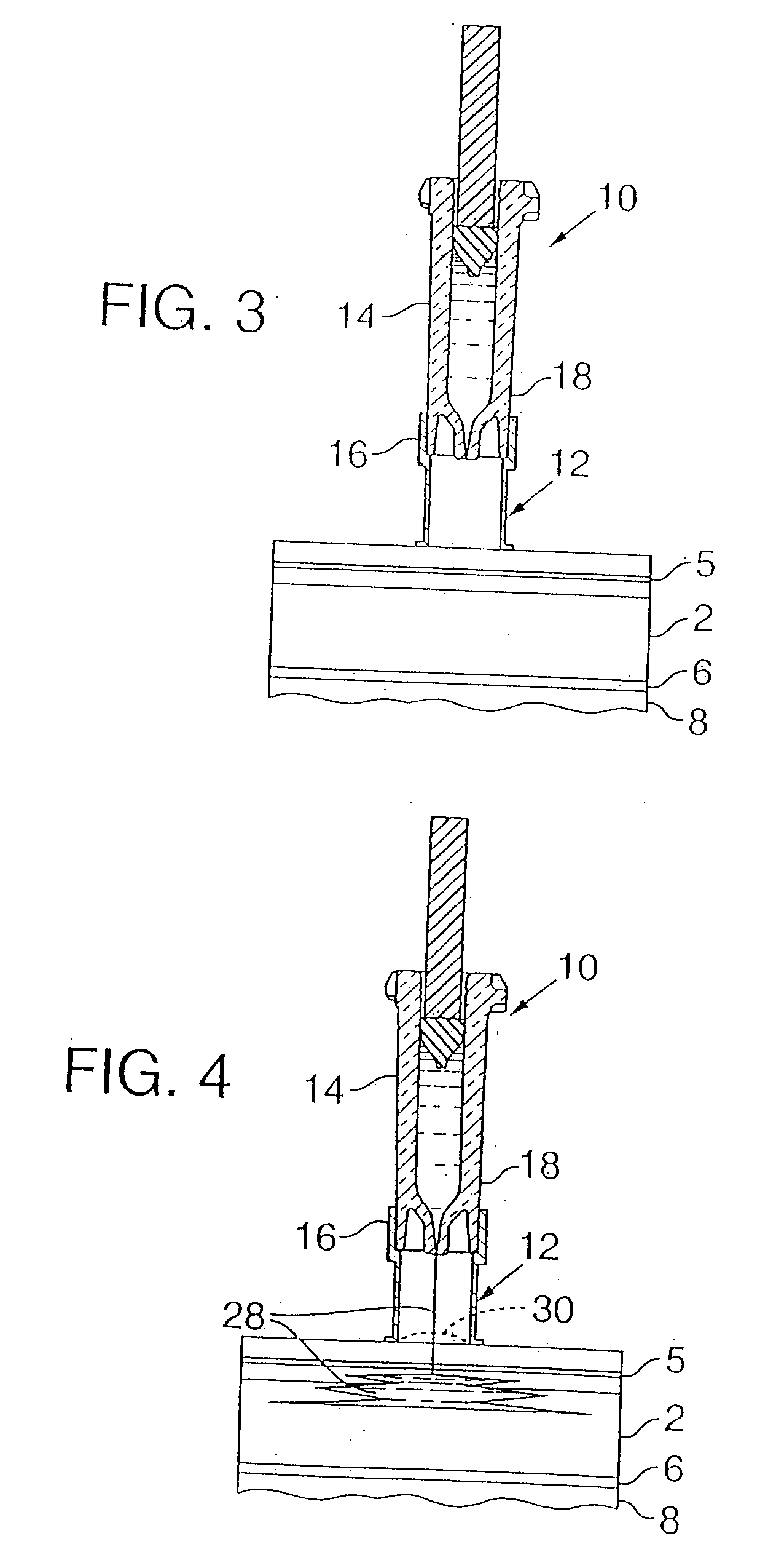 Intradermal injection system for injecting DNA-based injectables into humans