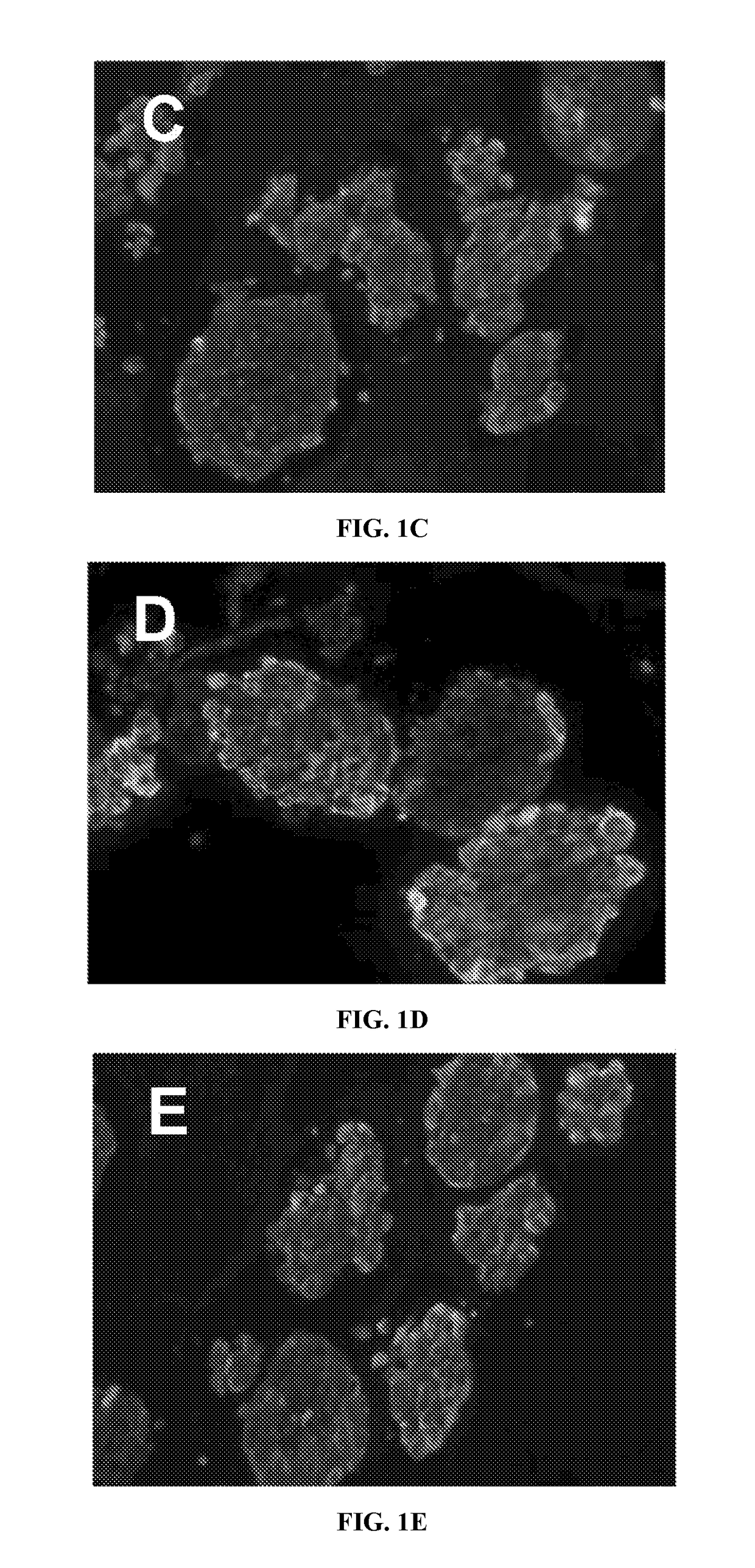 Three-dimensional scaffold culture system of functional pancreatic islets