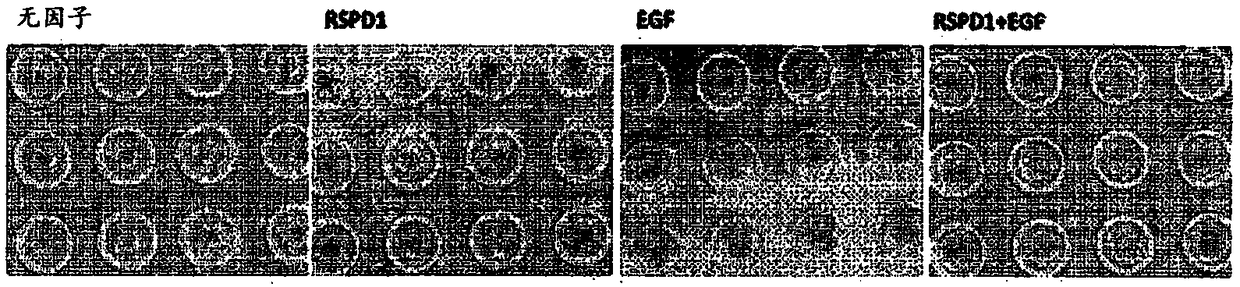 Purification method for pancreatic precursor cells derived from pluripotent stem cells and amplification method therefor