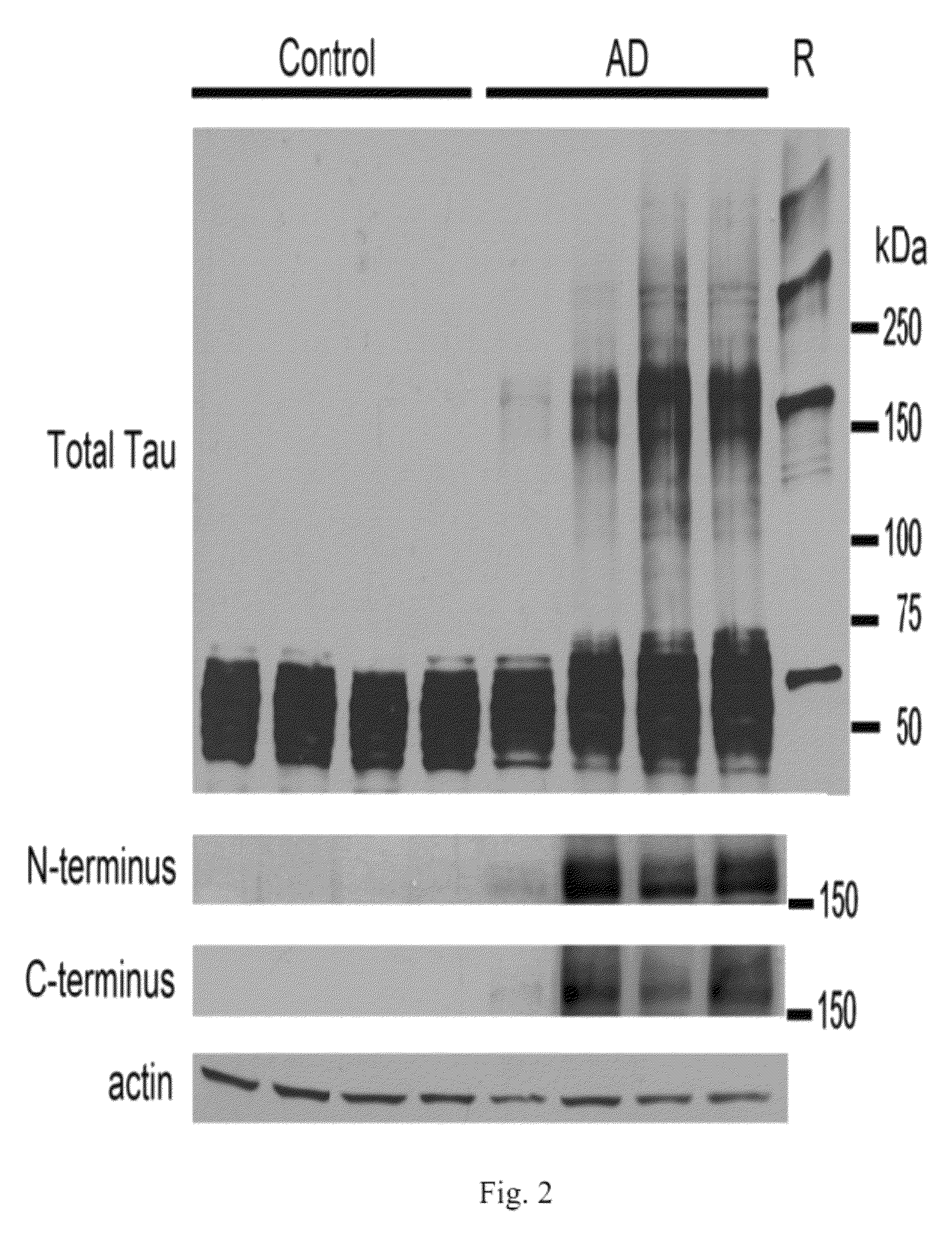 Antibodies selective for pathological tau dimers and prefibrillar pathological tau oligomers and their uses in treatment, diagnosis and monitoring of tauopathies