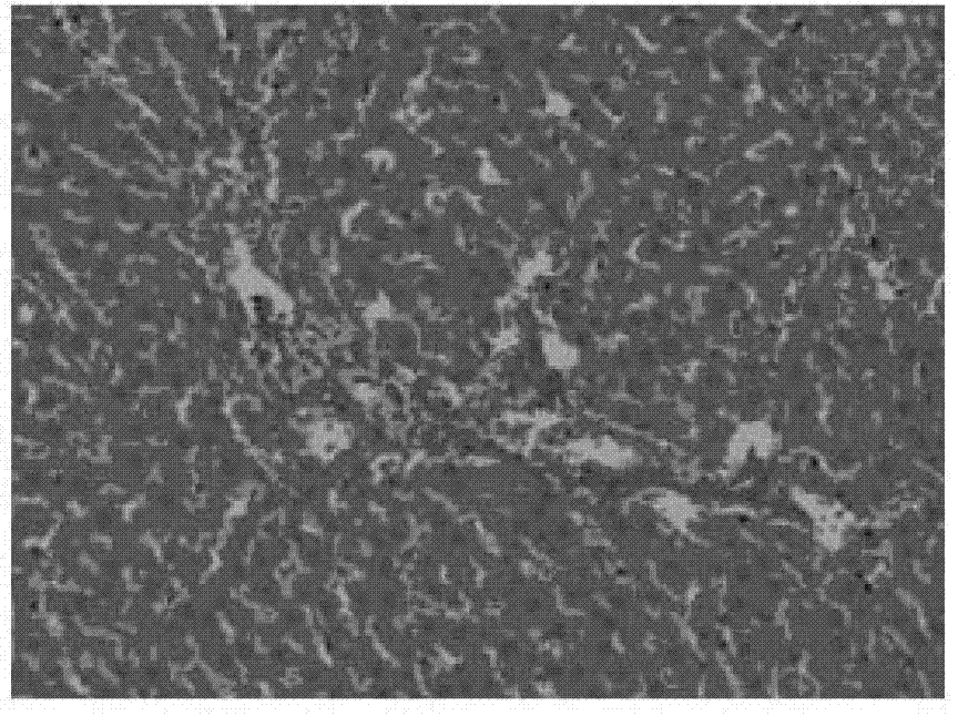 Pharmaceutical composition used for preventing and treating non-alcoholic fatty liver disease and application thereof