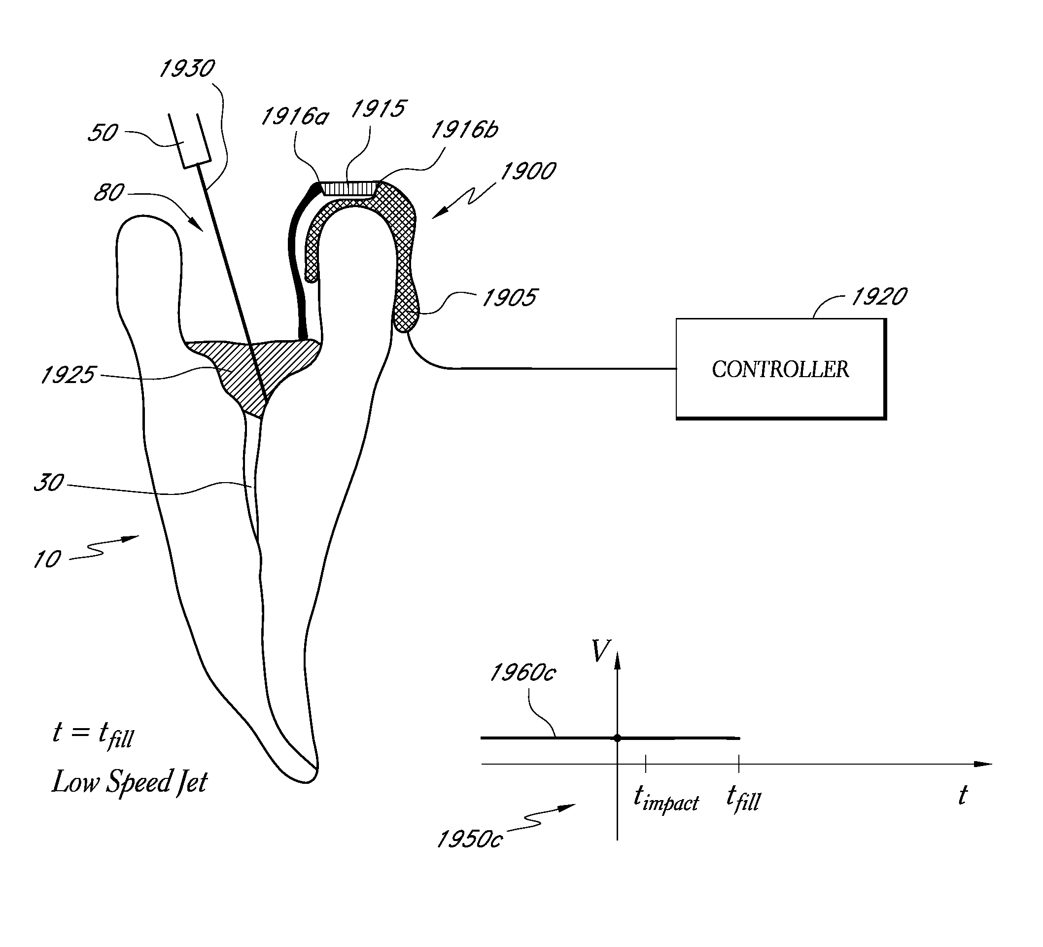 Apparatus and methods for monitoring a tooth