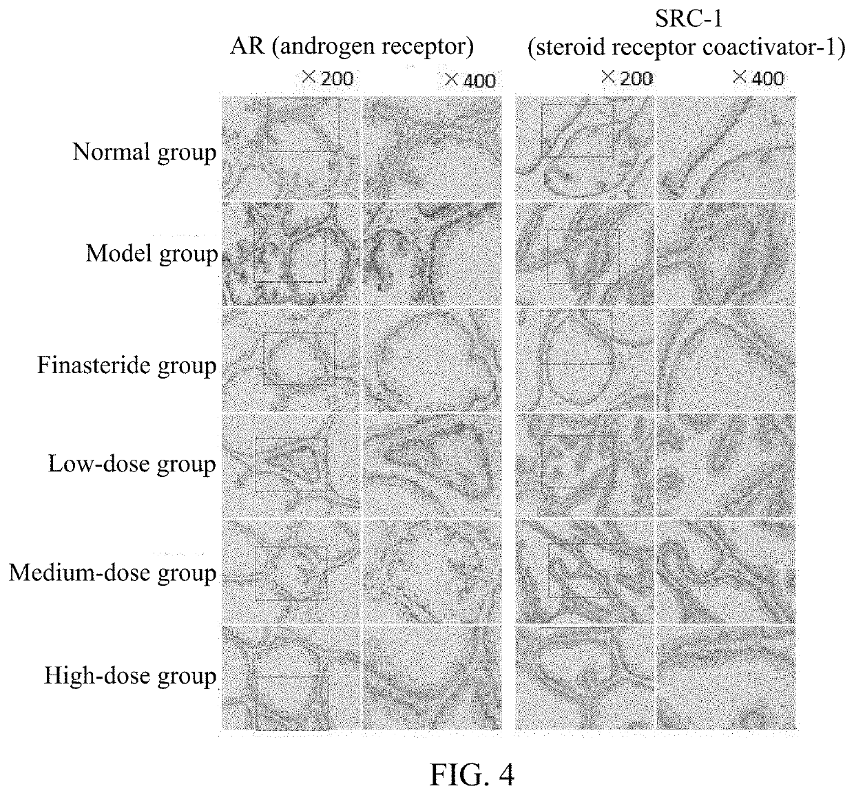 Sterol composition in pumpkin seed oil and application thereof, and drug for treating benign prostatic hyperplasia