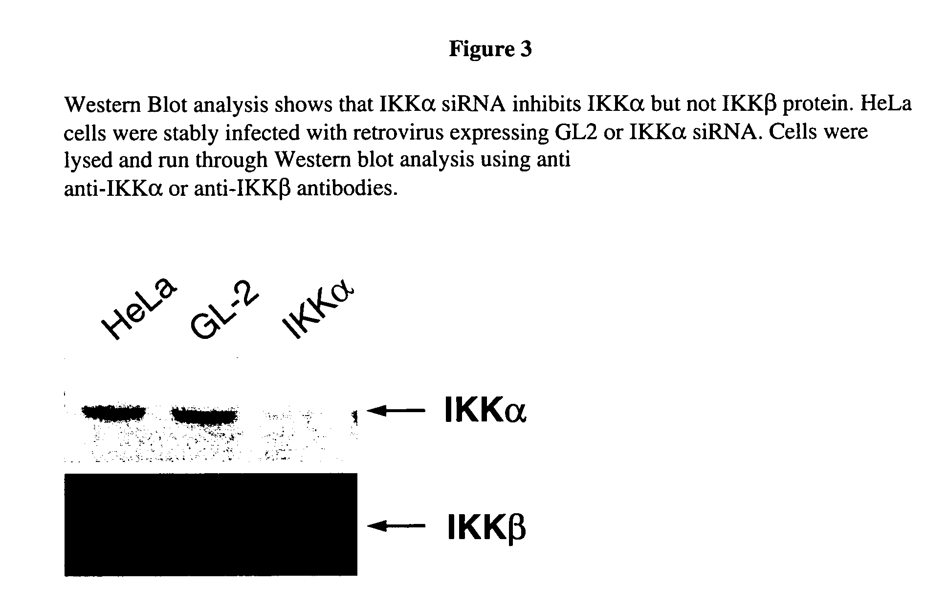 IKKalpha and IKKbeta specific inhibitors