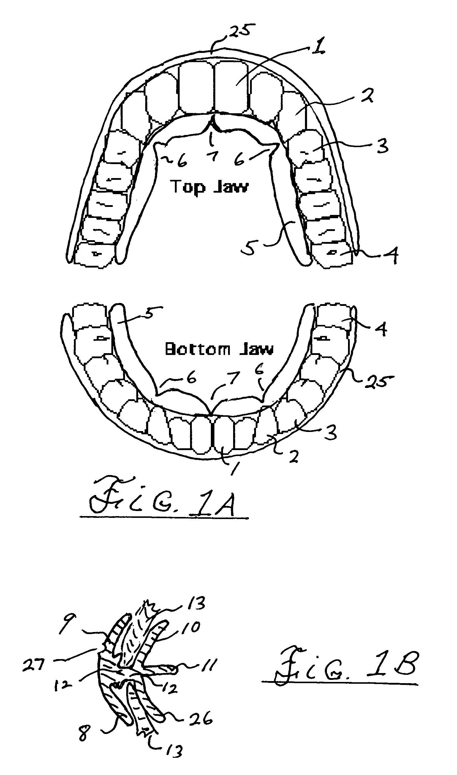 Method and system for swallow control resulting in improved posture