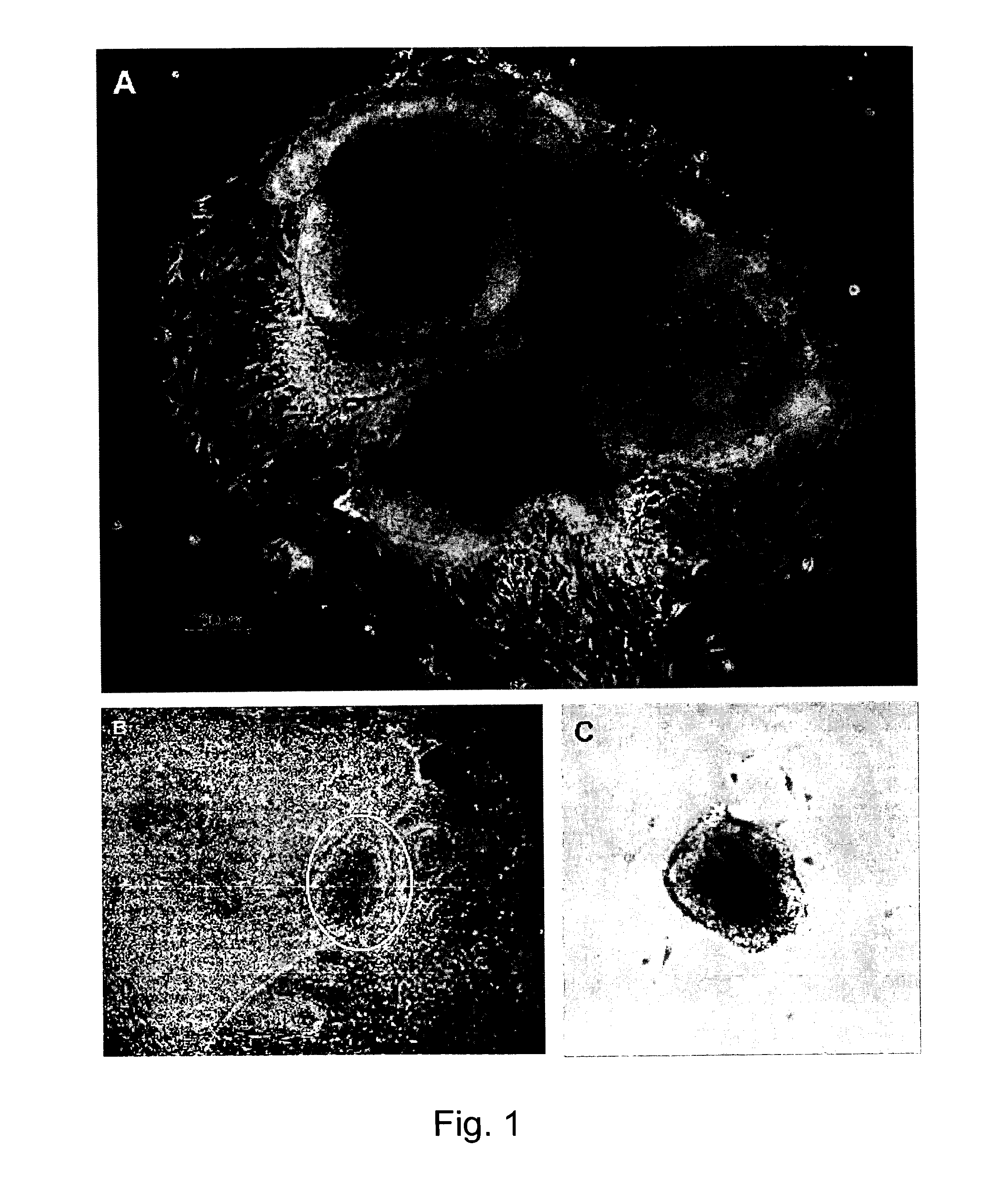 Cardiomyocyte-like cell clusters derived from hbs cells