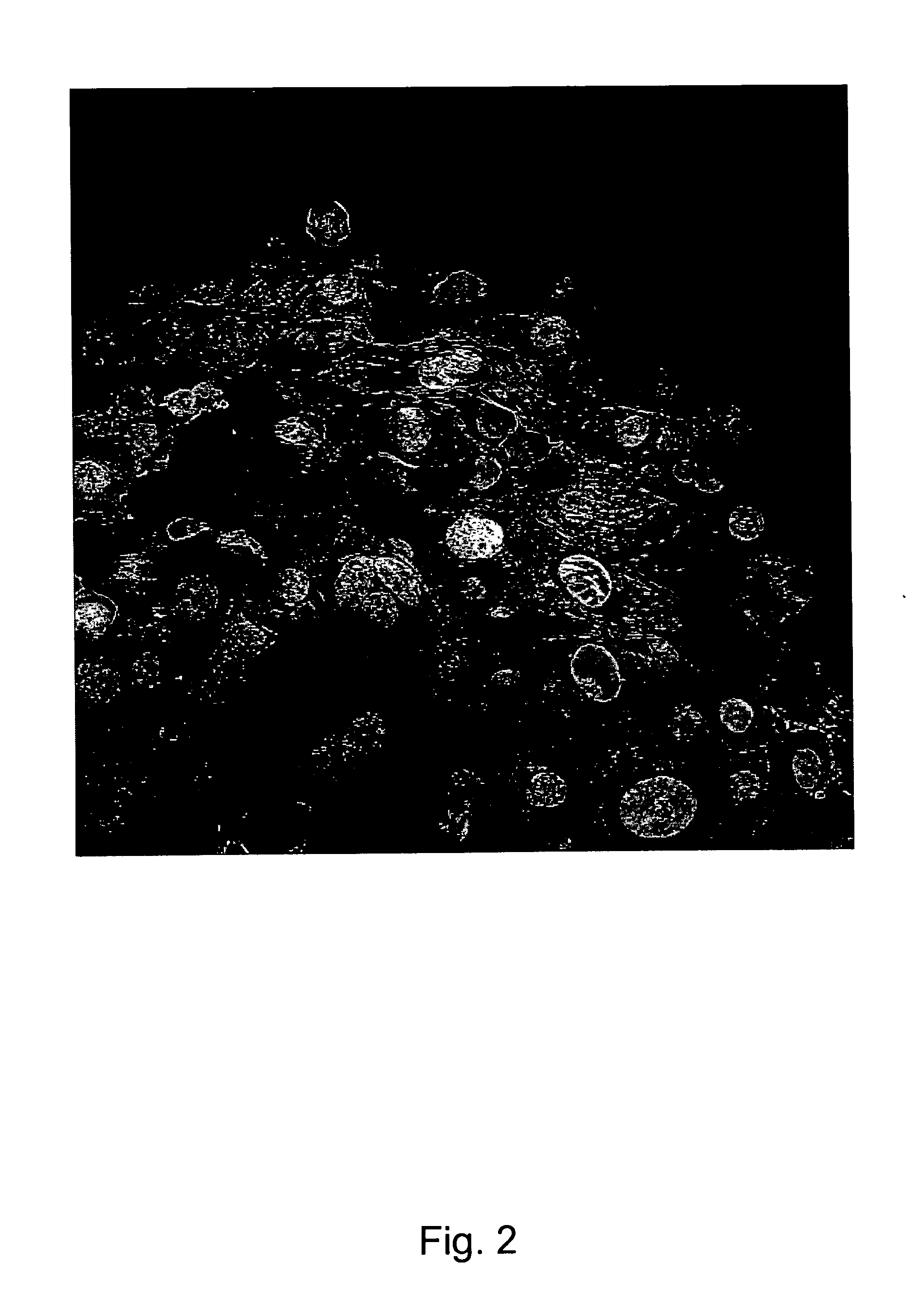 Cardiomyocyte-like cell clusters derived from hbs cells