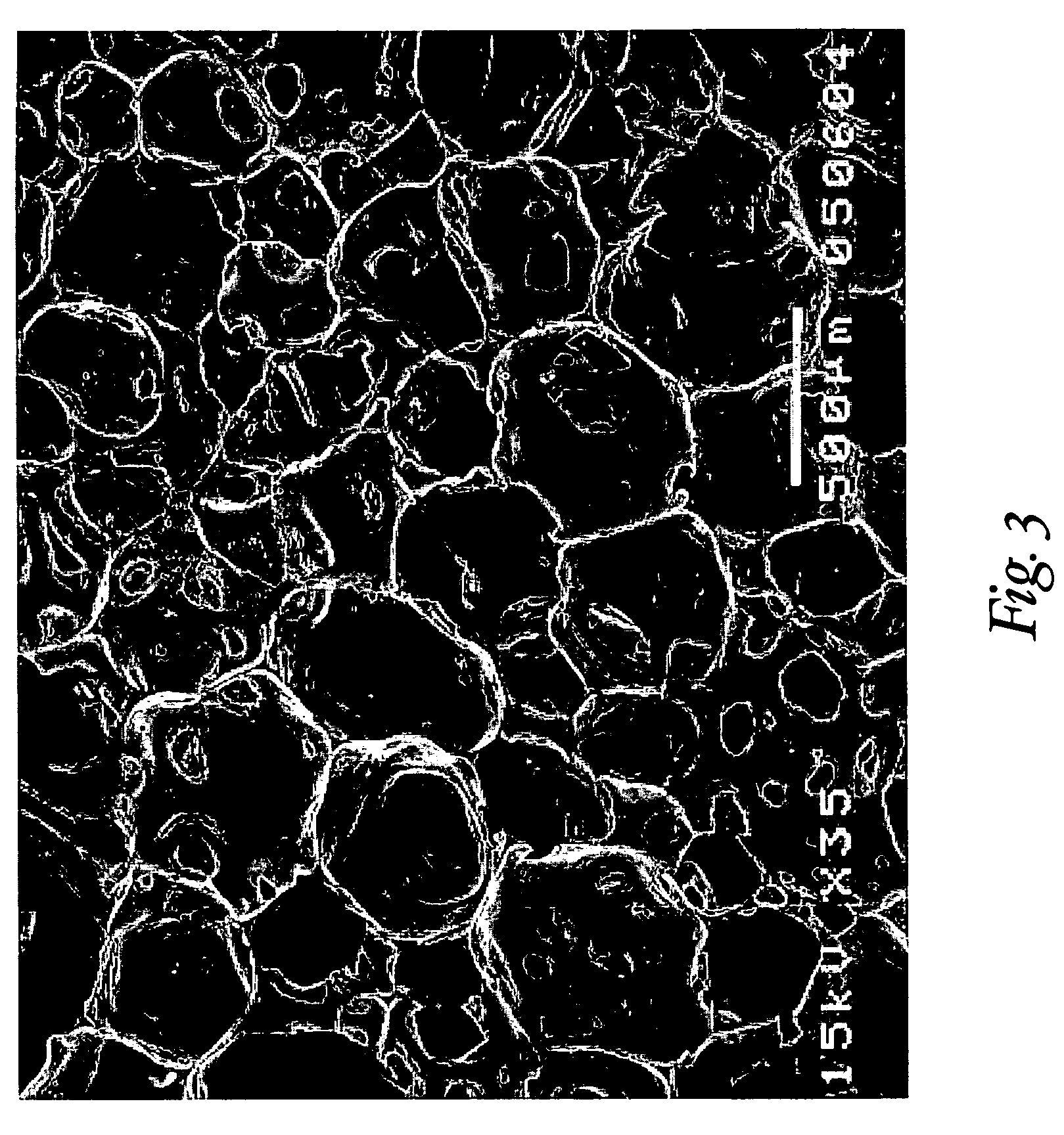 Reticulated elastomeric matrices, their manufacture and use in implantable devices