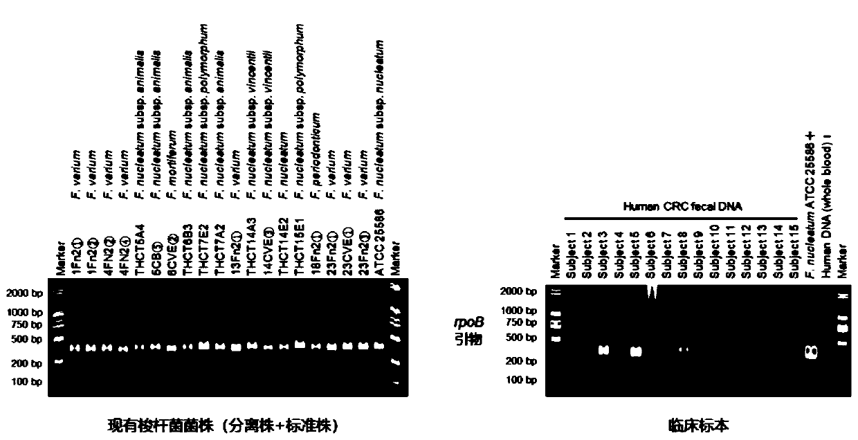 Method for carrying out molecular detection on fusobacterium or carrying out classified authentication on culture level of fusobacterium