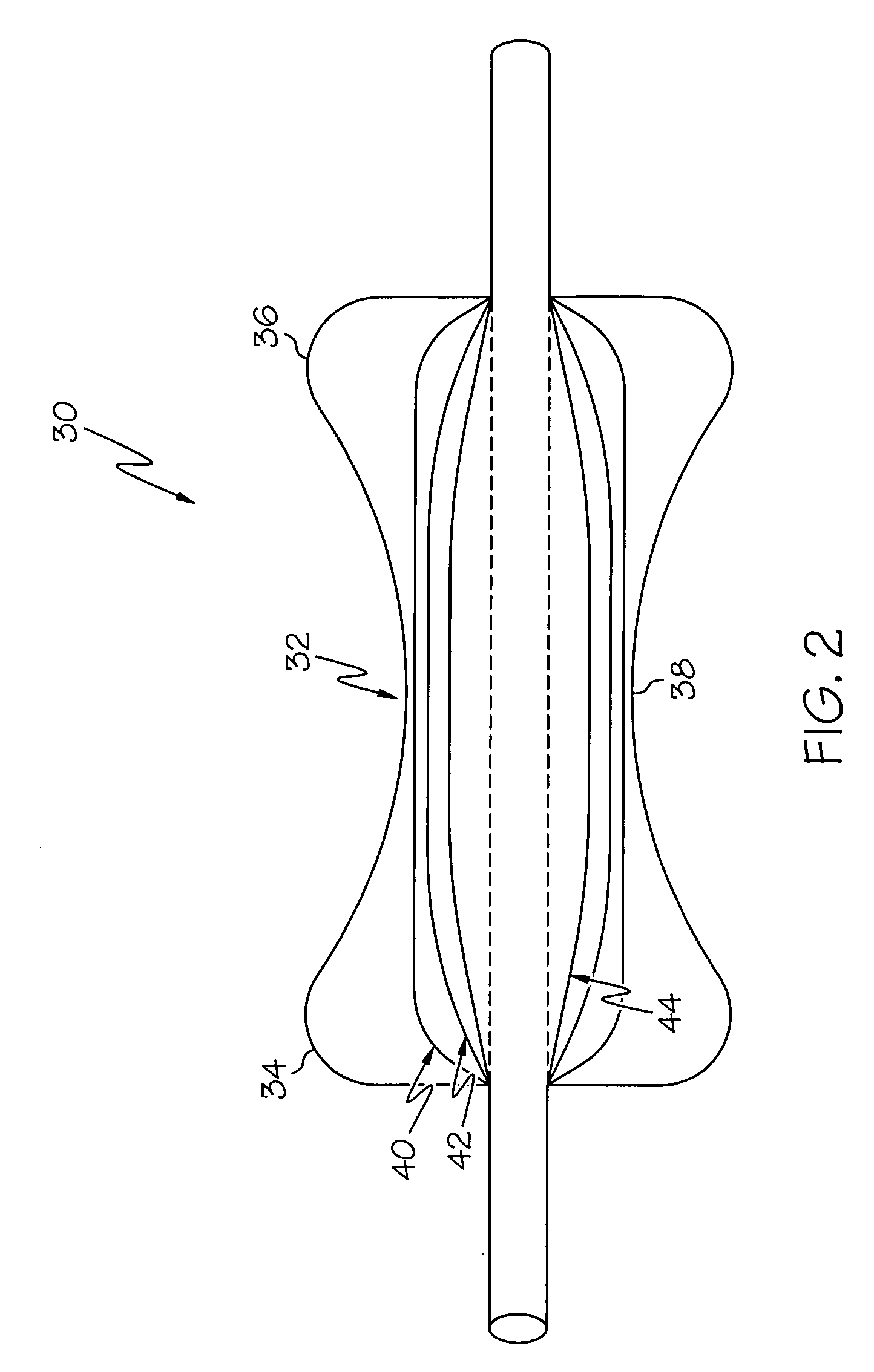 Airway balloon dilator