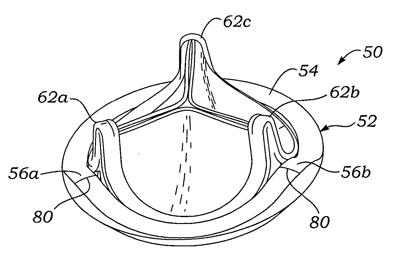 Methods of implanting a prosthetic mitral heart valve having a contoured sewing ring