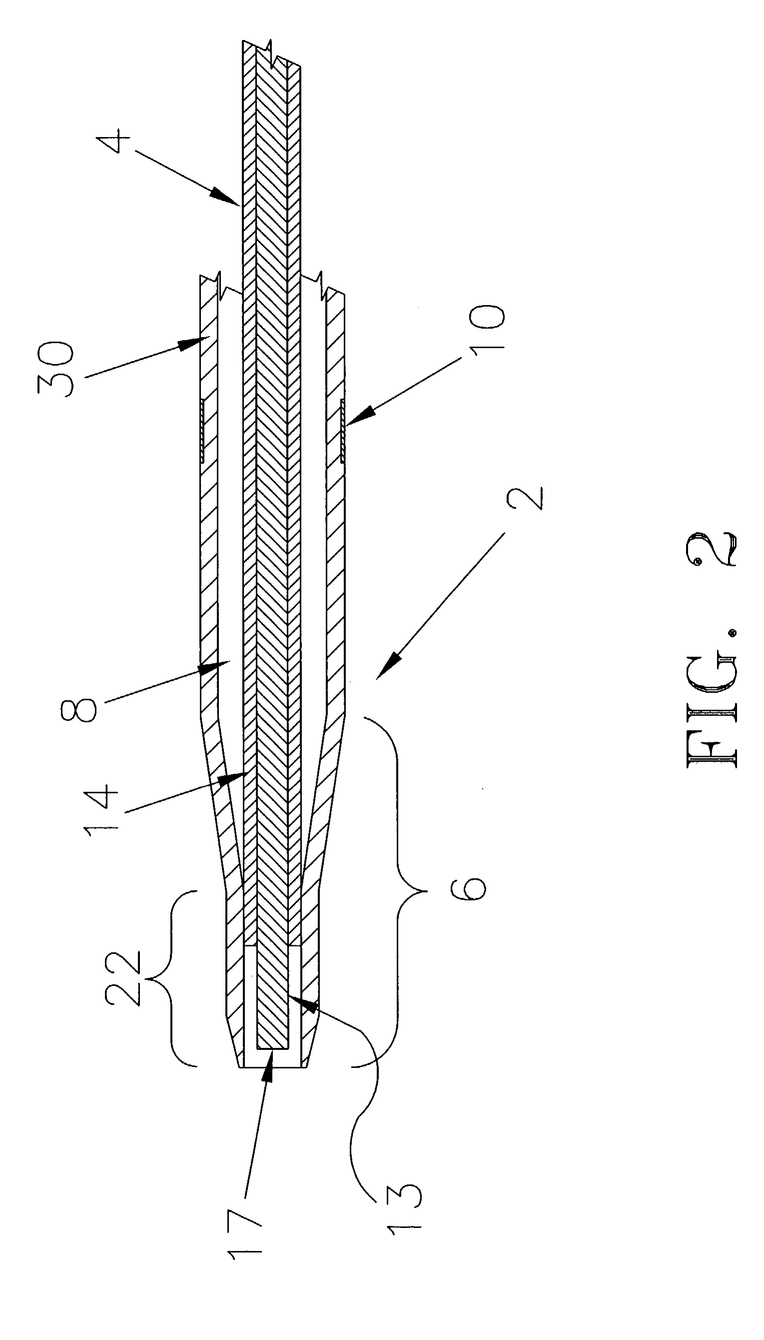 Vascular treatment device and method