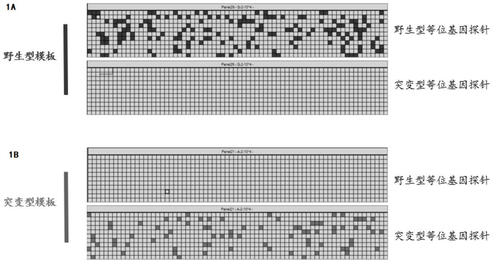 Application of SF3B1 gene mutation in auxiliary diagnosis on prolactin-type pituitary adenoma